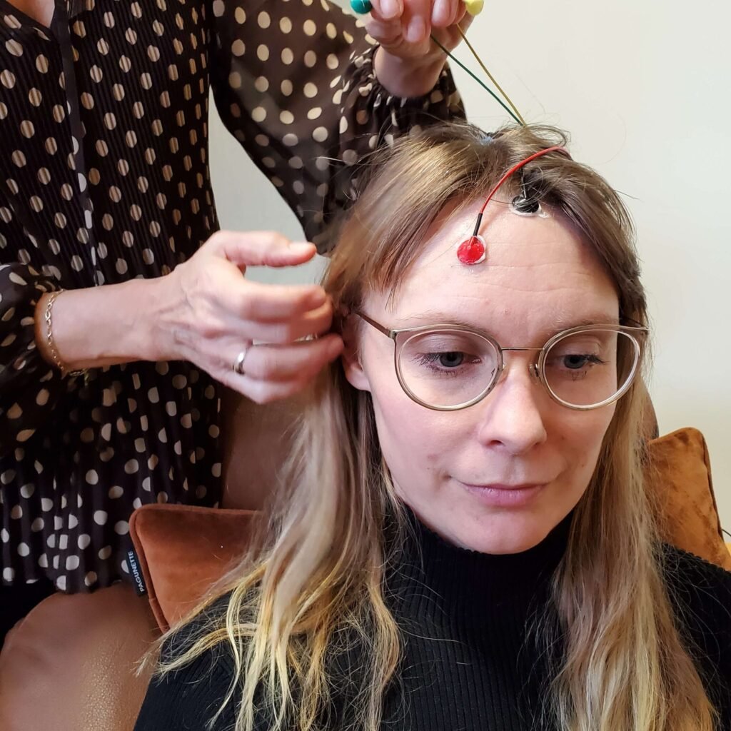 Elektroder placeres i haarbunden